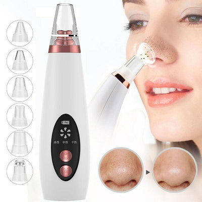 Blackhead Pore Vacuum & Acne Removal Tool